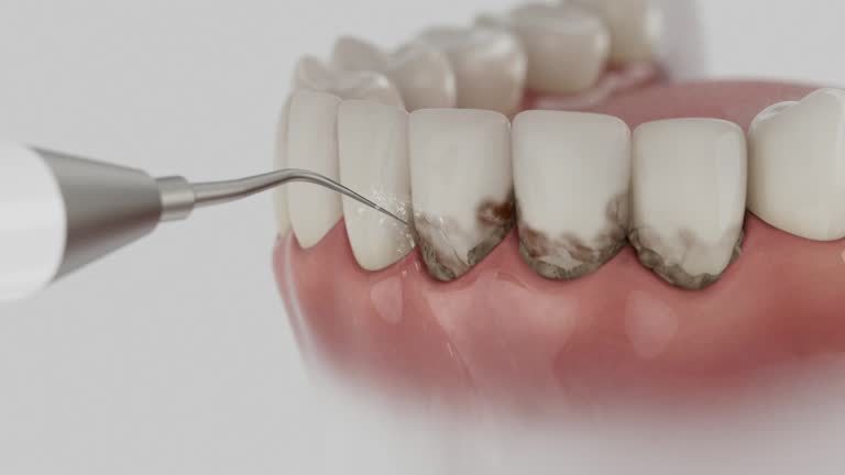 Reliable Tooth Extraction contractor in Leander, TX by Smile Center Dentistry
